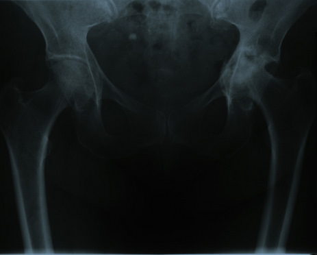 ebook advances in x ray