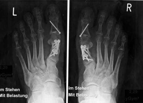 Gelenkzentrum Berlin | Hüftersatz, Kniegelenkersatz und Fußchirurgie
