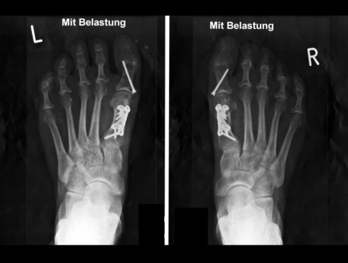 Gelenkzentrum Berlin | Hüftersatz, Kniegelenkersatz und Fußchirurgie